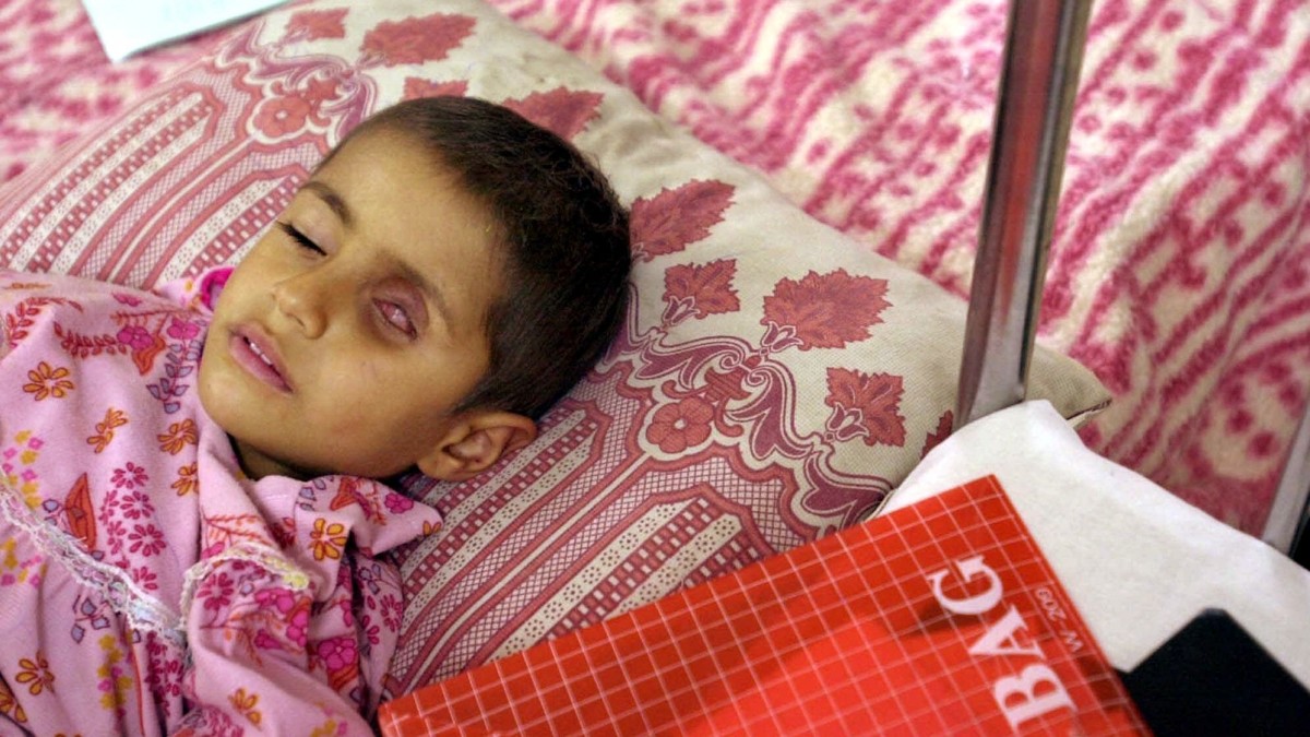 Four-year-old Alla Saleem, who suffers from a tumor in her eye, lies on her bed as she waits for medication Monday, January 15, 2001, at the Gazwan Children's Hospital in the southern Iraq town of Basra, about 60 kilometers (37 miles) from the border with Kuwait. Iraqi authorities claim that about 300 tons of bombs with depleted uranium were used by the allied forces during the Gulf War bombing campaign, and this is responsible for the increase of cancer cases in the area. According to Doctor Jawal Al-Ali, chief cancer consultant of the Basra teaching hospital and member of the Royal College of physicians in London, the cases have multiplied by 12 since 1991. (AP Photo/Enric Marti)