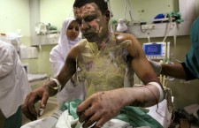 Palestinian Akram Abu Roka is treated for white phosphorous burns