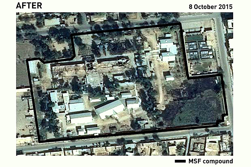 An aerial view of the damage on the Médecins Sans Frontières (MSF) / Doctors Without Borders hospital in Kunduz, Afghanistan, after the bombing by U.S.-backed forces. (Médecins Sans Frontières) An aerial view of the damage on the Médecins Sans Frontières (MSF) / Doctors Without Borders hospital in Kunduz, Afghanistan, after the bombing by U.S.-backed forces. (Médecins Sans Frontières)