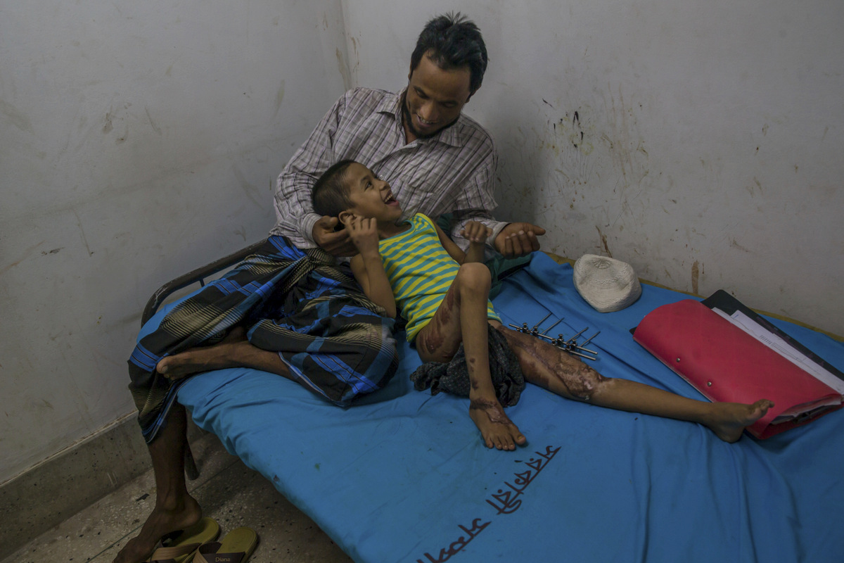 Rohingya girl Noor Fatima, plays with her father Muheeb-Ullaha as she recovers at Sadar Hospital in Cox's Bazar, Bangladesh, Wednesday, Sept. 27, 2017. Noor, was badly wounded four months back when Myanmar soldiers burned her house while she was inside. (AP Photo/Dar Yasin)