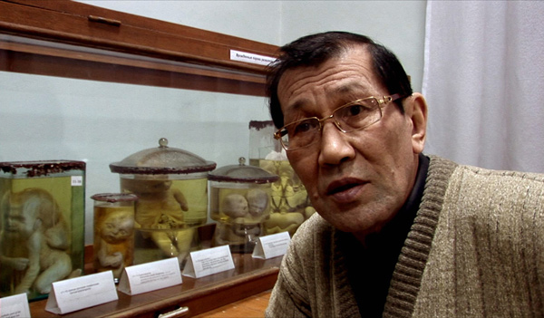 A photo of the doctor, in glasses, in front of preserved specimens of  malformed deceased infants.