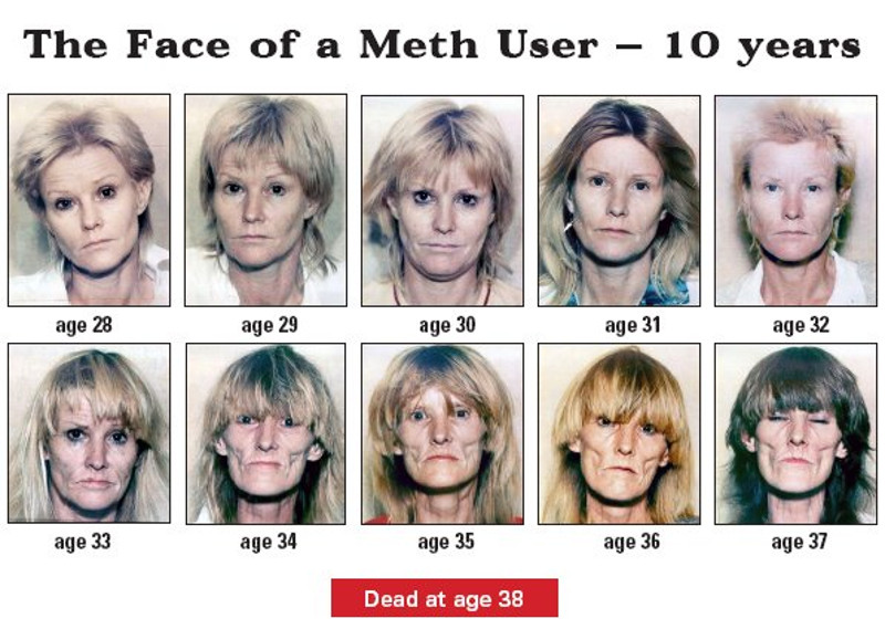 A series of 10 annual photographs show the decline in health of a female methamphetamine user over the course of a decade.