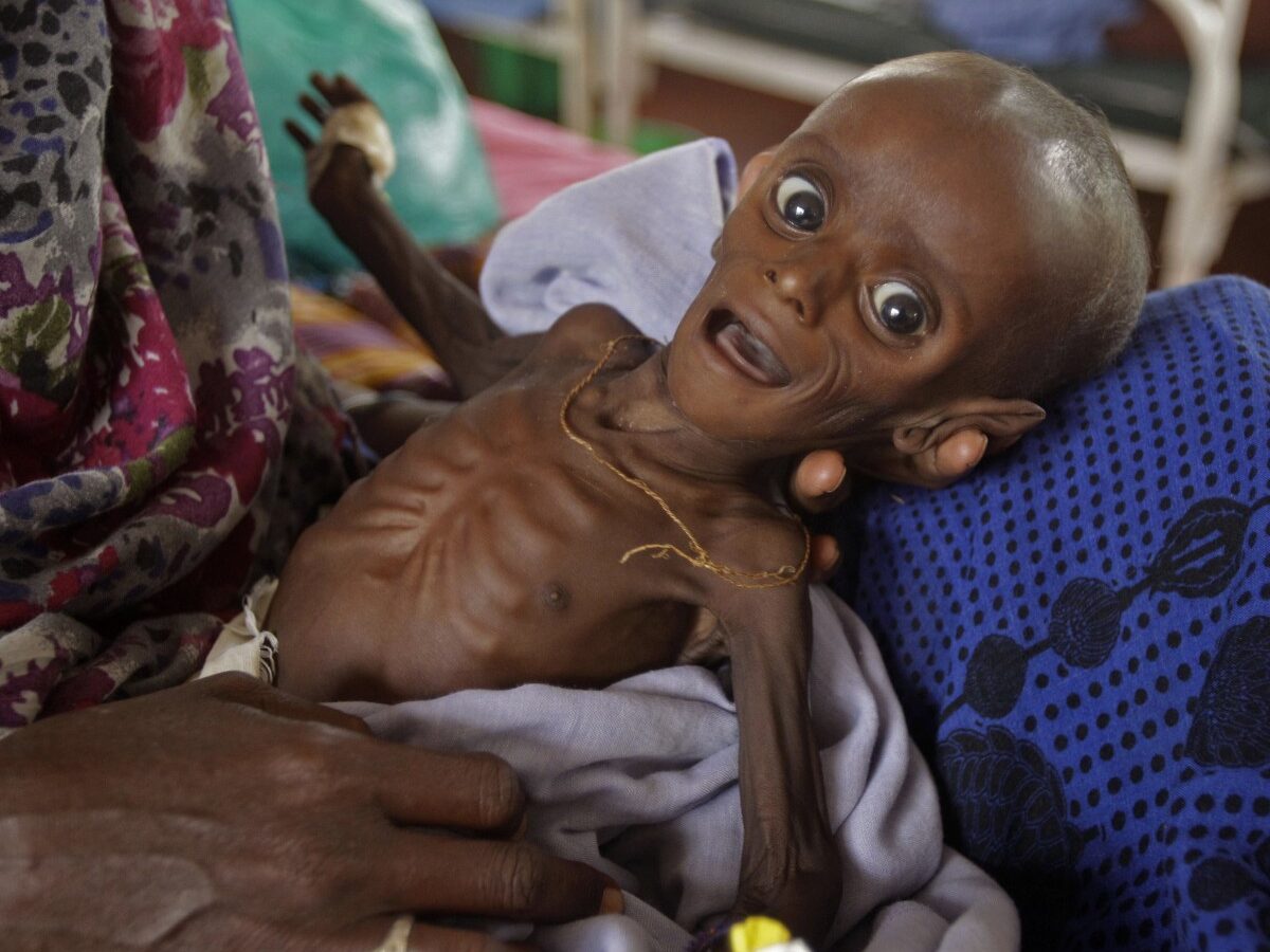 Seven month old Somali boy Minhaj Gedi Farah