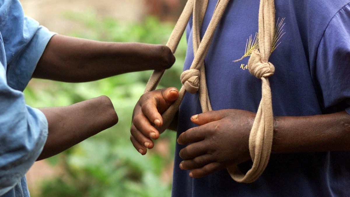 FILE In this Sept. 1, 1999 file photo, a Sierra Leonean whose two hands were hacked off by terrorist rebels helps another place a sling on his functionless hands, which were similarly hacked off at the wrists, but later sewn back for cosmetic reasons only, at the Camp for War Wounded and Amputees, in Freetown, Sierra Leone. On Thursday, April 26, 2012, judges at an international war crimes court will pass judgment on warlord-turned-Liberian president Charles Taylor, who is accused of sponsoring rebels responsible for untold atrocities during Sierra Leone's brutal civil war in return for so-called blood diamonds. The historic verdicts at the Special Court for Sierra Leone will mark the first time an international tribunal has reached judgment in the trial of a former head of state since Nuremberg.(AP Photo/Brennan Linsley, File)