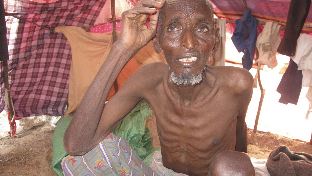 A Somali man from southern Somalia rests in a makeshift shelter in Mogadishu, Somalia, Friday, July 22, 2011. (AP Photo/Mohamed Sheikh Nor)