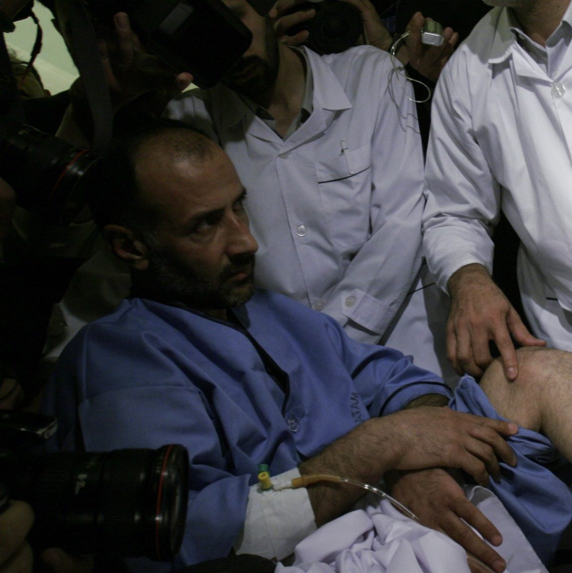 Iranian dermatologist Ali Hosseini, shows the foot of Iranian diplomat Jalal Sharafi, during a news conference at Iran's Foreign Ministry in Tehran, Iran Wednesday, April. 11, 2007. The Iranian diplomat has accused the CIA of torturing him during his detention in Iraq. Claims of torture have not been independently verified. (AP Photo/Hasan Sarbakhshian)