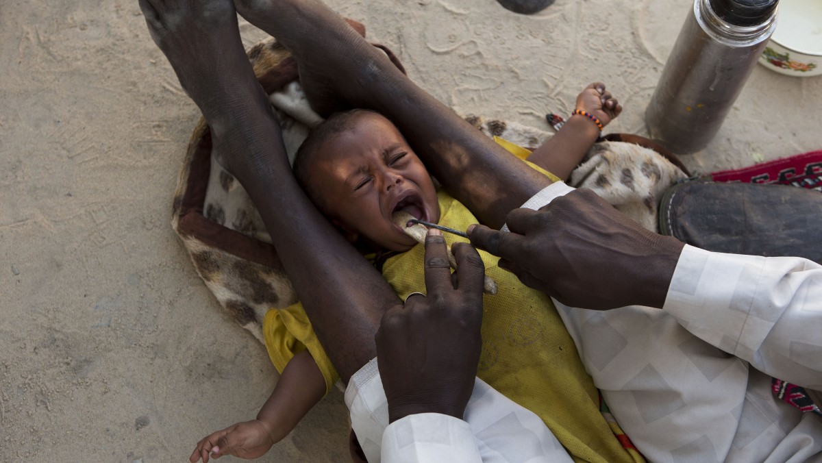 In this Nov. 5, 2012 photo, traditional healer Hakki Hassan cuts out the epiglottis of 8-month-old Moustafa Abdallah Lamine before also removing four un-erupted baby teeth as a treatment for vomiting and diarrhea, in Moussoro, Chad. (AP Photo/Rebecca Blackwell)