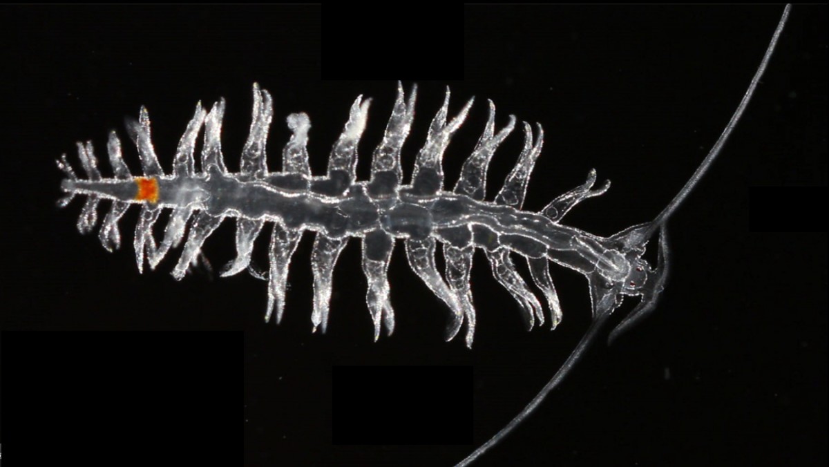 One of the very many micro-organisms living in the oceans. (Photo S. Sardet - CNRS - Tara Expeditions)