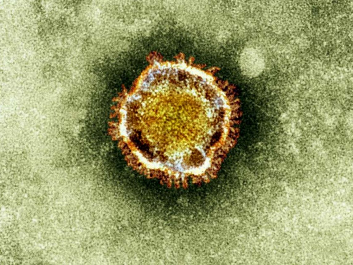 Italy Reports First Case Of Coronavirus
