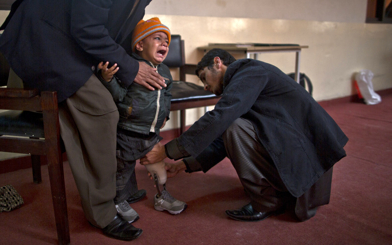 A Pakistani child cries from pain while a therapist applies on his artifical limb at the Armed Forces Institute for Rehabilitation Medicine in Rawalpindi, Pakistan.  (AP Photo/Muhammed Muheisen)