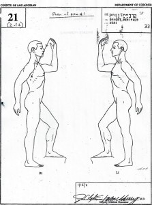 The diagram from the coroner's office showing the trajectory of the fatal bullet.