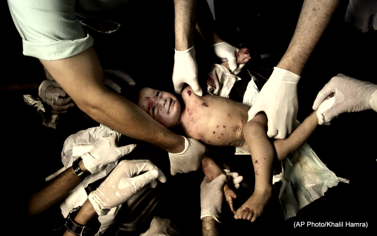 In this July 18, 2014 Palestinian medical personnel treat a wounded girl at the emergency room of the Shifa hospital in Gaza City, northern Gaza Strip following an Israeli bombing campaign.