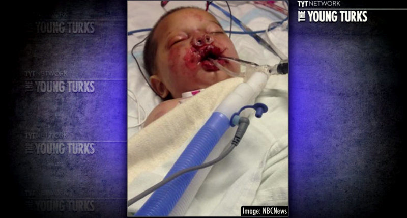 VIDEO: Police Raid Severely Burns Toddler And County Refuses To Cover Medical Bills