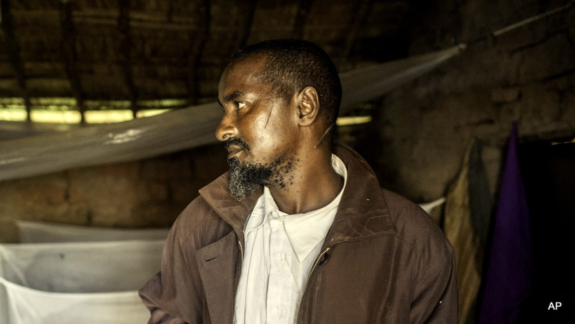 In this Aug. 28, 2014 photo, Saidou Bouba, stands for a photo in Boda, Central African Republic. Bouba, a Muslim, was attacked by the Anti Balaka, his entire family was wiped out and he received several machete wounds but survived. As U.N. peacekeepers prepare to go into the Central African Republic to take over a regional mission, the death toll since fighting between Muslims and Christians started in December underscores how the aid is coming too late for thousands of victims.