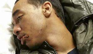 Marcus Abrams, 17, shows a cut lip and swollen jaw after what his family says was unjustifiably rough treatment by Metro Transit police Monday, Aug. 31, 2015, after Abrams was spotted on the light-rail tracks near Lexington Parkway Station in St. Paul. A Metro Transit spokesman said the agency is investigating the incident. (Courtesy Neenah Caldwell) 