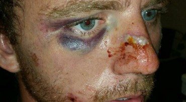 ‘The Police Are Supposed To Be The Good Guys,’ Man Beaten For Looking Suspicious