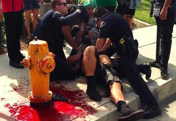 Police StandBy While KKK Members Go On Stabbing Rampage Against Protesters In California
