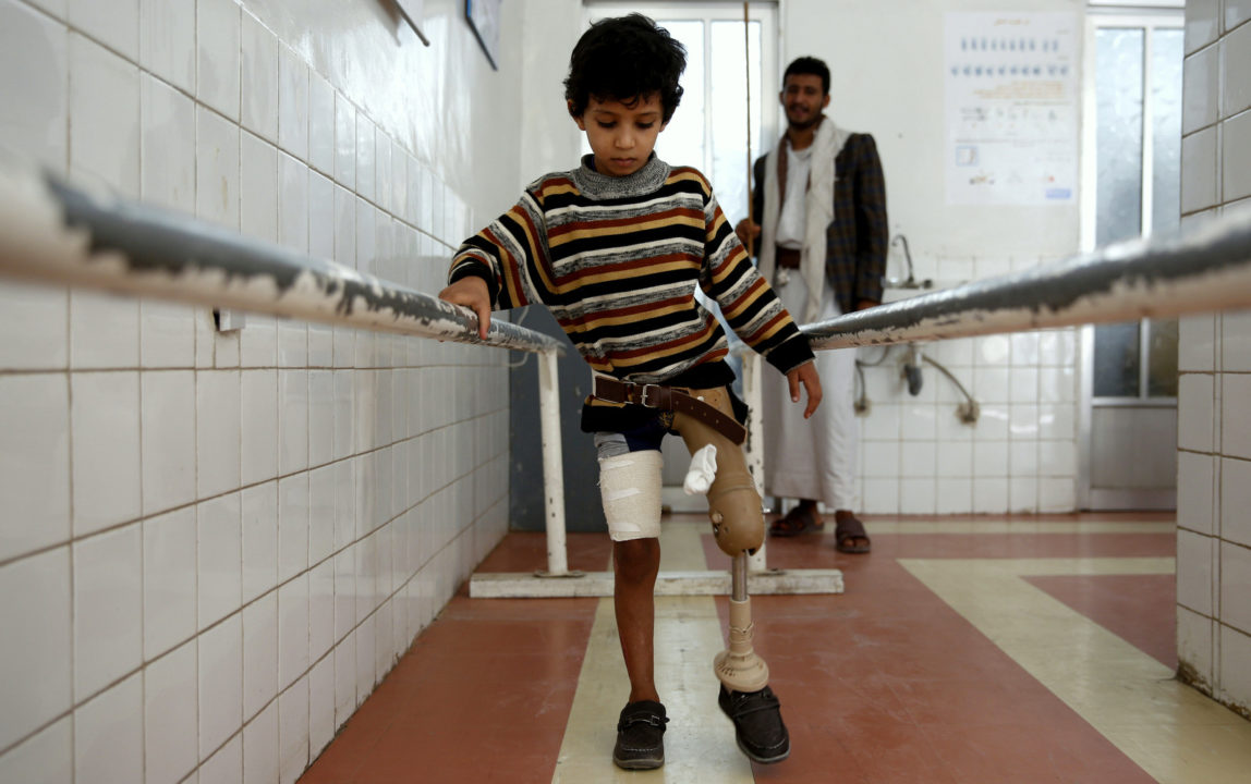 A young boy who lost his leg in the Yemen war uses a prosthetic limb at a government-run rehabilitation center in Sanaa, Yemen, Saturday, March 5, 2016. Yemen's conflict pits the government, backed by the Saudi-led coalition, against Shiite rebels known as Houthis allied with a former president. Yemen's war has killed at least 6,200 civilians and injured tens of thousands of Yemenis, and 2.4 million people have been displaced, according to U.N. figures. (AP Photo/Hani Mohammed)