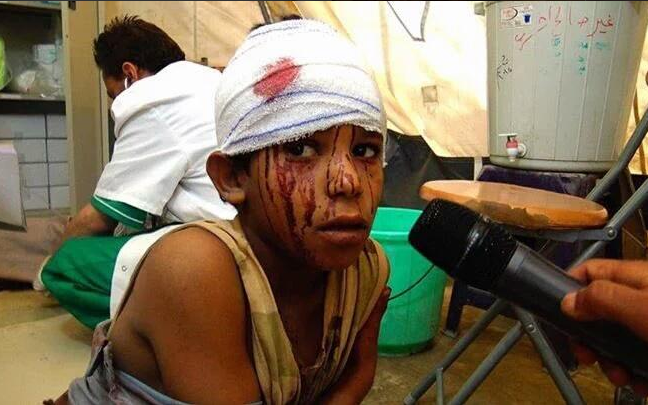10 Children Killed,28 Wounded In US-Backed Coalition Strike In Yemen