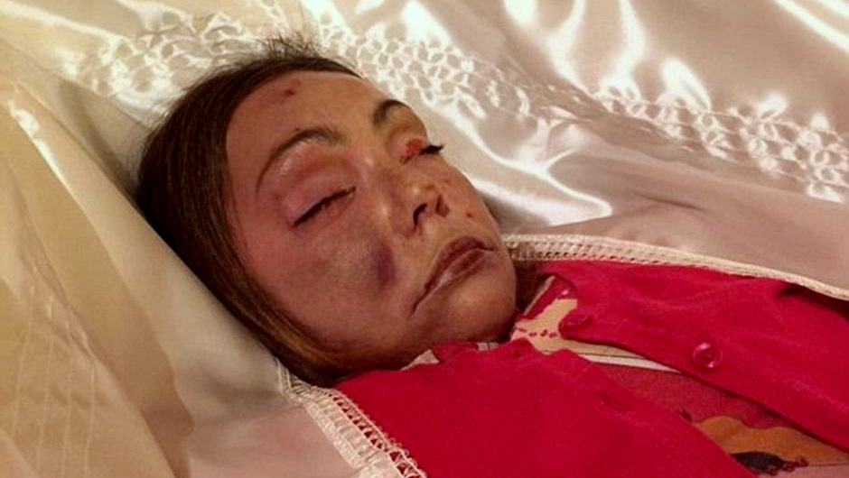 The family of Julie Pearson, who was found dead in the Israeli resort of Eilat, has published this photo of her body in a coffin, in a desperate attempt to challenge the claims of the Israeli police that she died of natural causes. (Photo: Pearson Family)