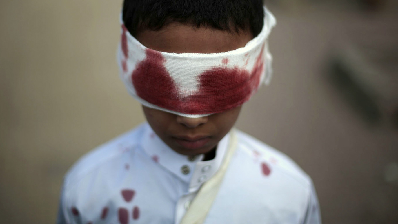 A boy with fake blood on his face and clothes to represent a victim participates in a protest against Saudi-led airstrikes in Sanaa, Yemen, Sunday, Nov. 27, 2016. (AP/Hani Mohammed)