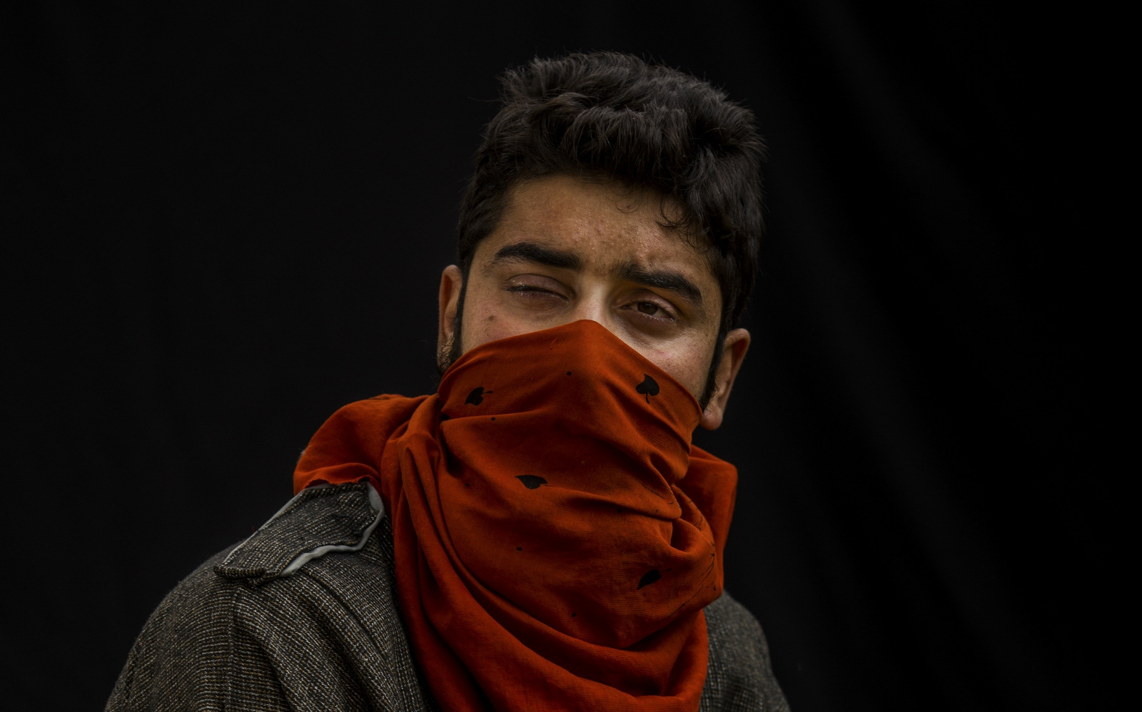 Tanveer poses for a portrait with his face partially covered, near Baramulla, Indian-controlled Kashmir. Tanveer lost eyesight on his right eye because metal pellet injuries. "I was an earning hand of my family. I feel like a living dead." he says. (AP Photo/Bernat Armangue)