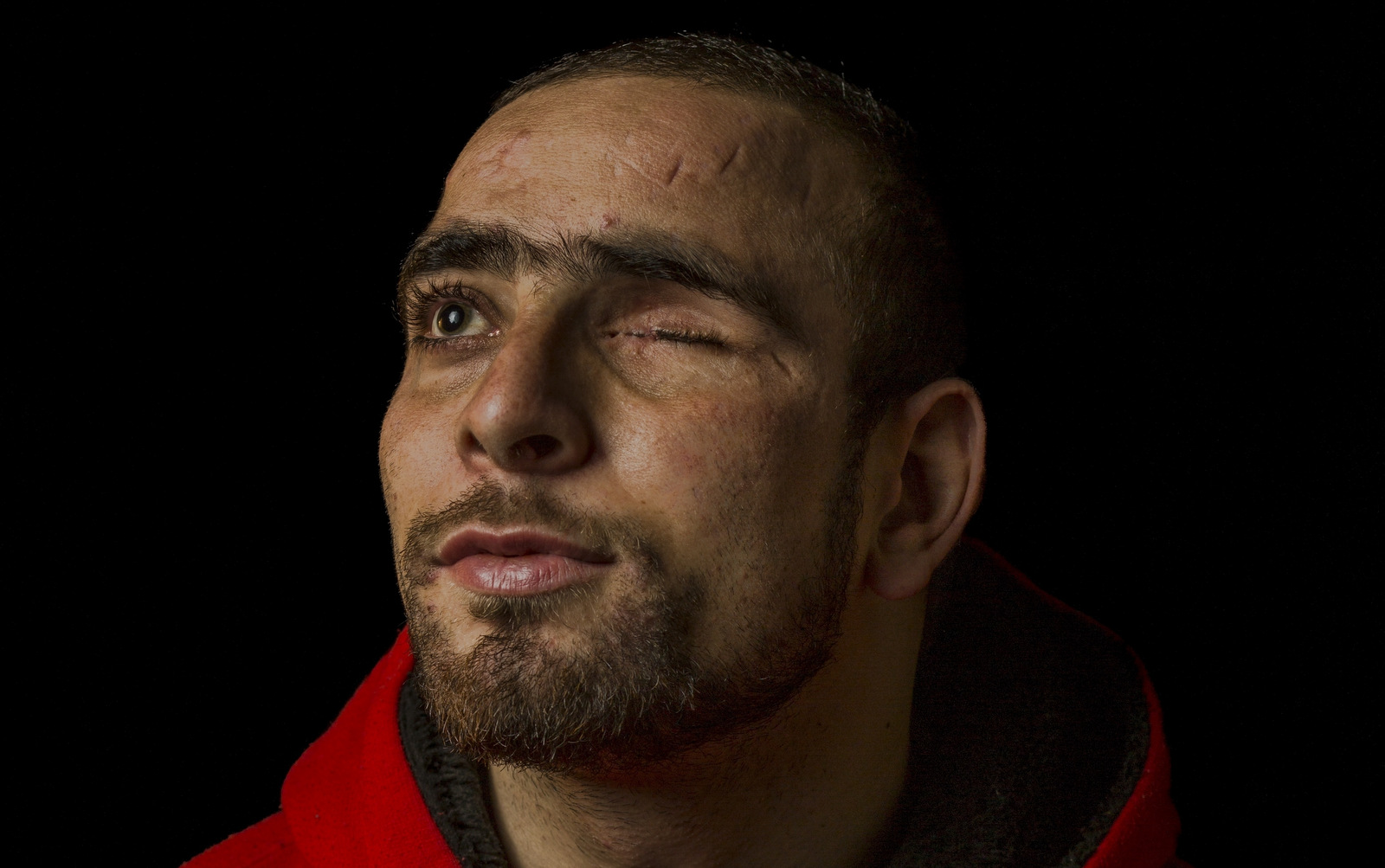 Danish Rajab Jhat, 24, poses for a portrait in Srinagar, Indian-controlled Kashmir. "My left eye is completely damaged and with my right eye I can only see some sort of shadows, not clear vision." Dec. 1, 2016. (AP/Bernat Armangue)