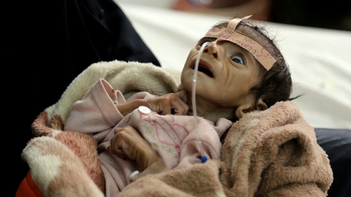 Genocide In Yemen: Media Complicit In US-Saudi War Crimes