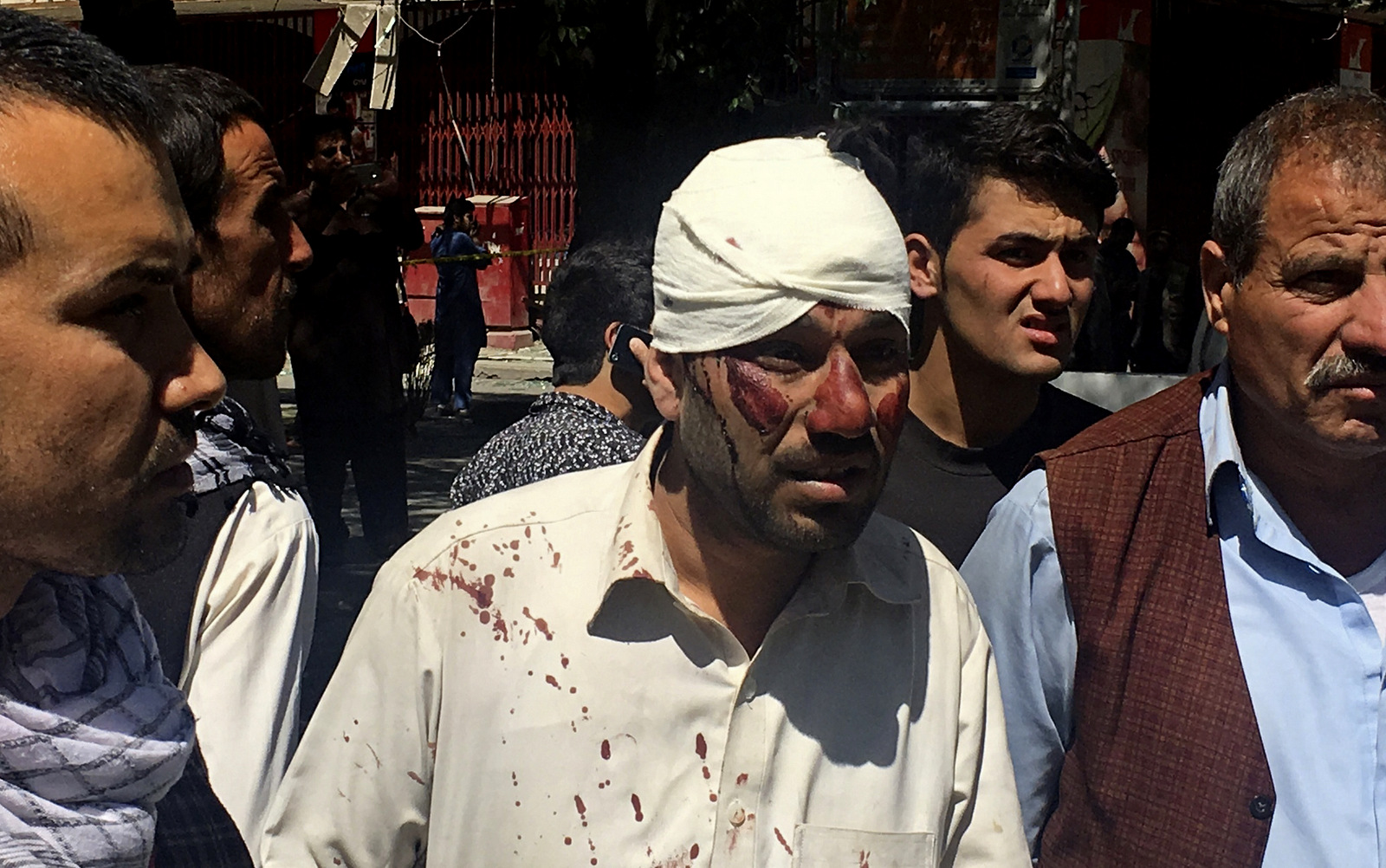 An injured man is seen after an explosion in Kabul, Afghanistan, Wednesday, May 31, 2017. (AP/Rahmat Gul)