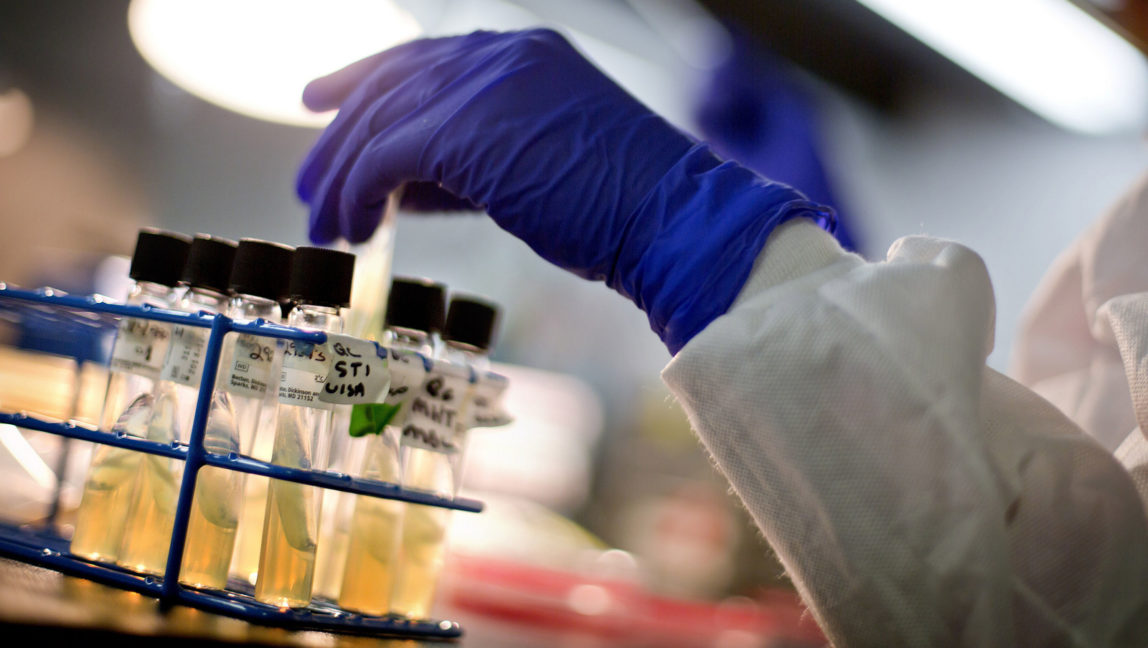 A microbiologist works with tubes of bacteria samples in an antimicrobial resistance and characterization lab within the Infectious Disease Laboratory at the Centers for Disease Control and Prevention in Atlanta. (AP/David Goldman)