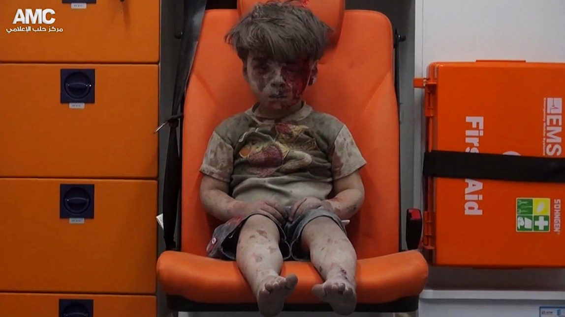 The now infamous photo of Omran Daqneesh as he sits in an ambulance in Aleppo, Syria.