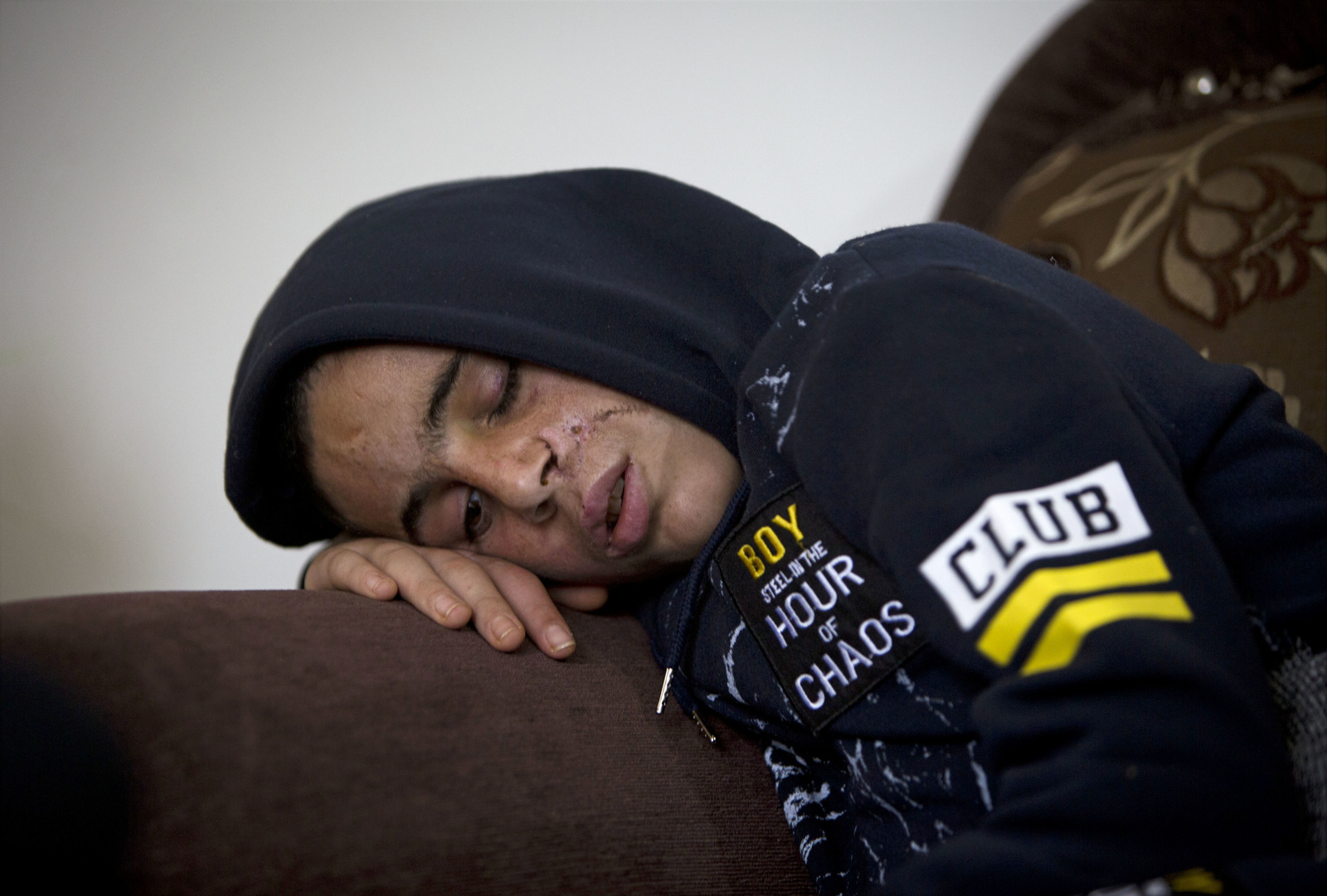 Mohammed Tamimi, Ahed Tamimi's 15-year-old cousin, sits in his family home in Nabi Saleh, recovering from a serious head injury sustained after being shot by Israeli troops on Dec. 15. Relatives say Mohammed's injury was one of the triggers for Ahed Tamimi's outburst later that day in which she kicked and slapped two Israeli soldiers, Jan. 5, 2018. (AP/Majdi Mohammed)