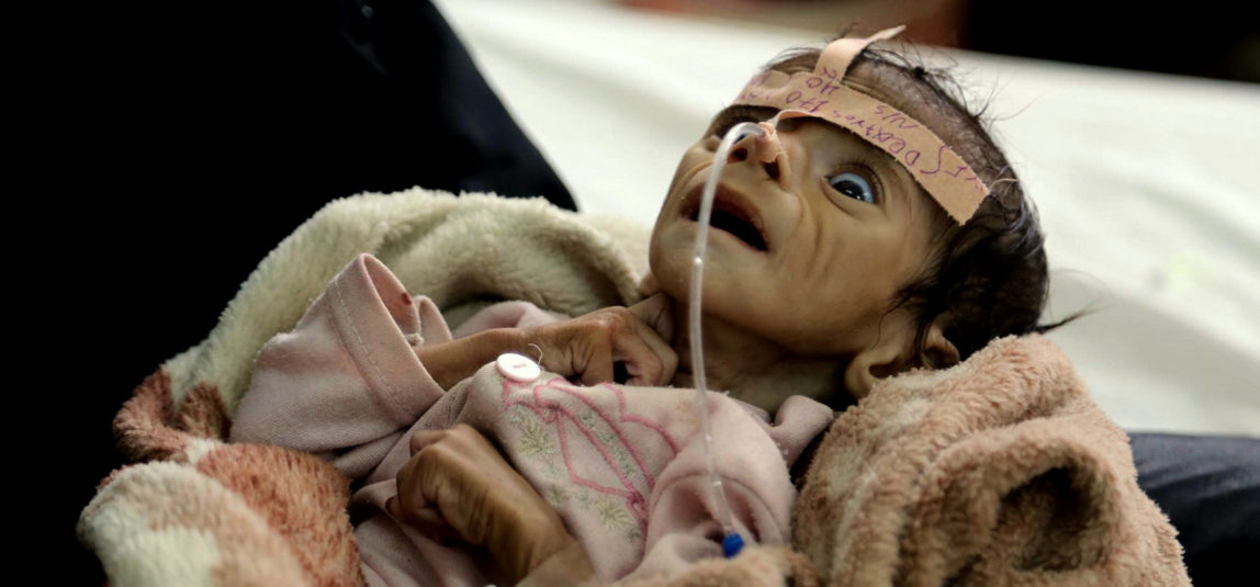 Why 55 U.S. Senators Voted for Genocide in Yemen