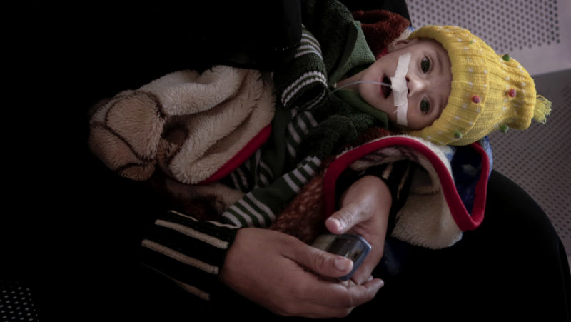 Gawad Awad, a severely malnourished Yemeni 4-month-old, lies in the lap of his mother, Heba Ahmed, in the Al-Sadaqa Hospital in Aden, Yemen, this Feb. 13, 2018 photo. Gawad weighed 2.5 kg (5.5 pounds). Aden’s hospital is the best supplied in southern Yemen, but many of the other hospitals around the south are short of supplies and under staff, and families with starving children can’t afford to make the trip to Aden. (AP/Nariman El-Mofty)