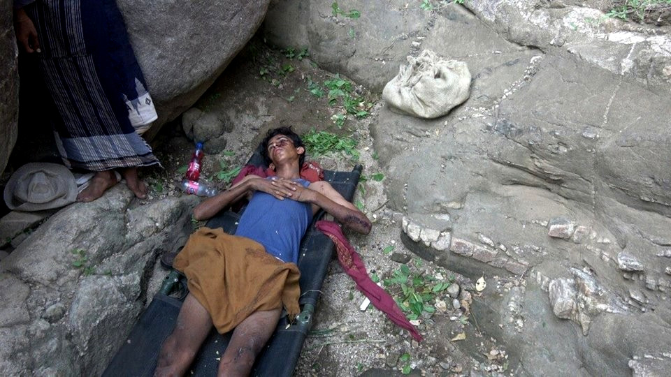 一名受害者在沙地区繁忙市场发生沙特阿拉伯空袭后等待注意，该地区与也门Saada，也门，2011年6月18日接壤。照片| YemenExtra