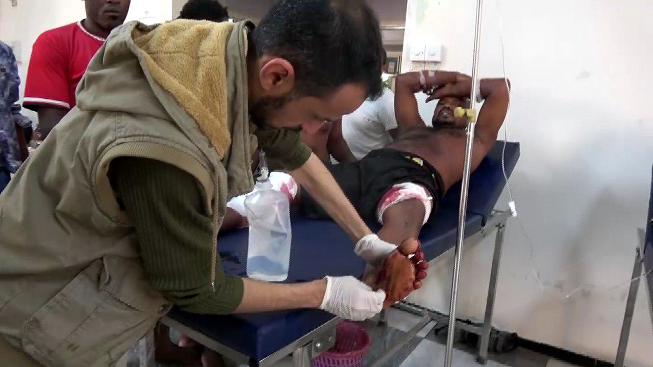 A worker, who wished not to be identified, is treated in the Hodeida Hospital following a Saudi caolation airstrike on workers in central Hodeida, Yemen. June 20, 2018. Photo | Ahmed Abdulkareem