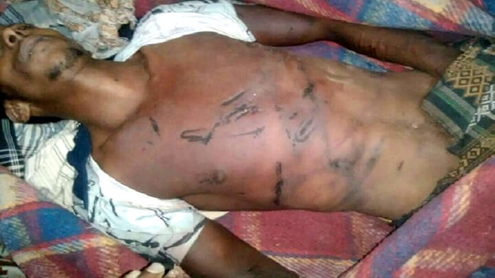 Una foto que muestra el cuerpo de Ahmed Dabeh, un joven de la ciudad de Jaar, en la provincia de Abyan, en Yemen. Dabeh fue asesinado como resultado de la violenta tortura que sufrió en una prisión secreta de los Emiratos Árabes Unidos el 29 de septiembre de 2017. En su cuerpo se ven huellas de tortura. Fotos | Cortesía de la familia Dabeh