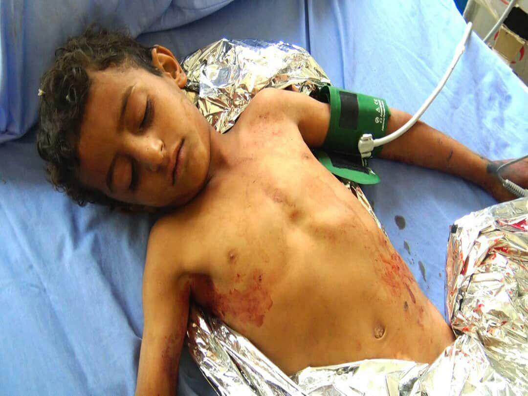 星期三沙特空袭萨达的一名身份不明的受害者。照片|艾哈迈德·阿卜杜勒·卡里姆