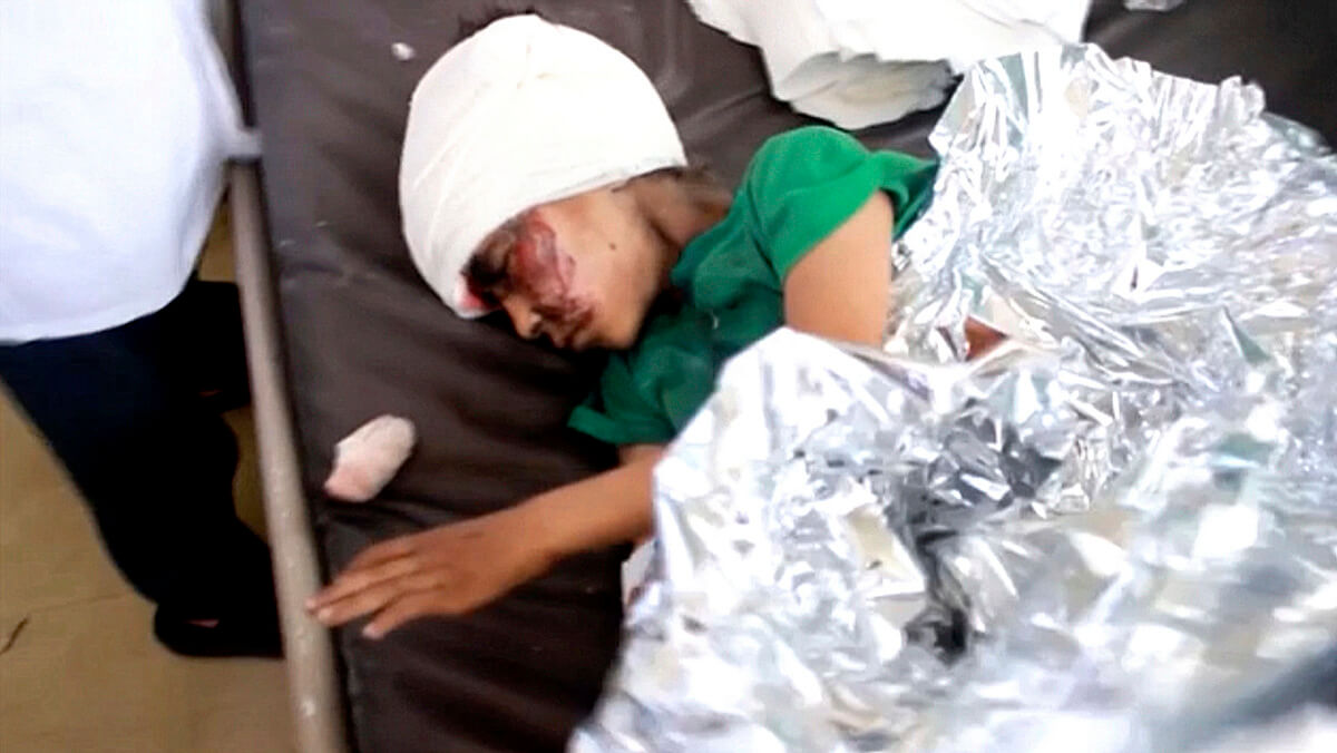 This image made from video taken on Thursday, Aug. 9, 2018, shows a child injured in a Saudi airstrike on a school bus resting at a hospital in Saada, Yemen. AP Video via AP