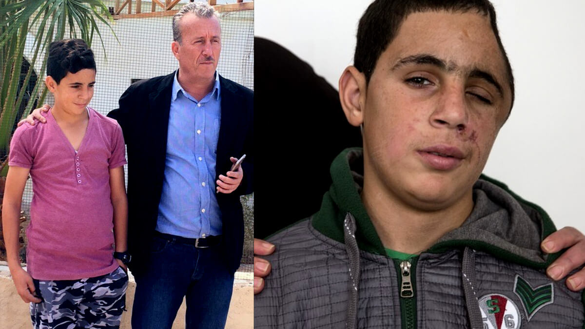 Mohammad Tamimi antes y después