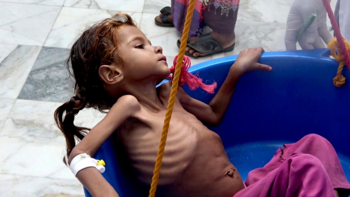 在沙特再次袭击中，也门的520万儿童现在面临饥饿