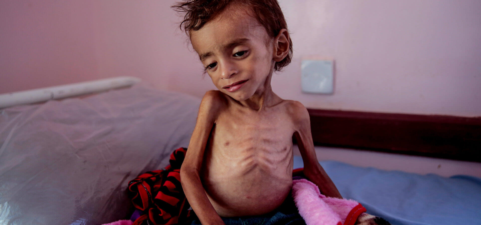 Yemen Famine