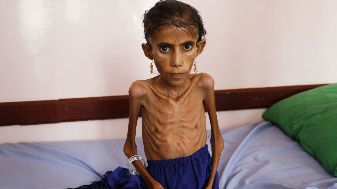 Йеменский голод