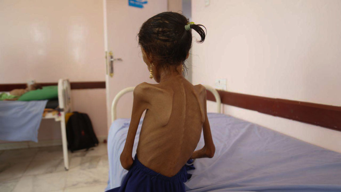 五年过去了，沙特对也门农民的袭击使整个国家陷入饥荒