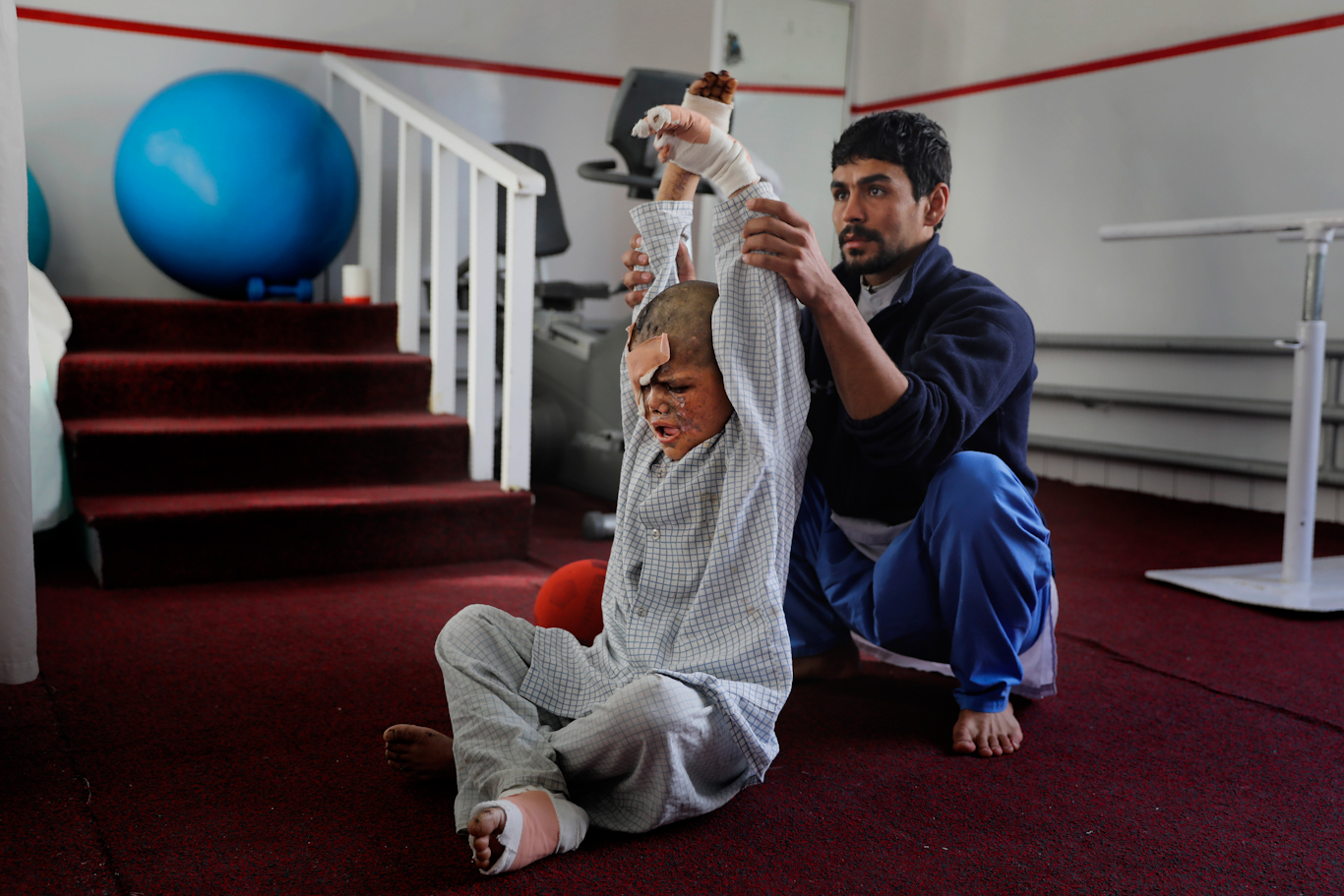 A physiotherapist helps nine-year-old Eimal, who has lost his right eye and several fingers on his hands in a landmine blast, stretch at Emergency Surgical Center for Civilian War Victims in Kabul, Afghanistan, Dec. 5, 2019. Altaf Qadri | AP