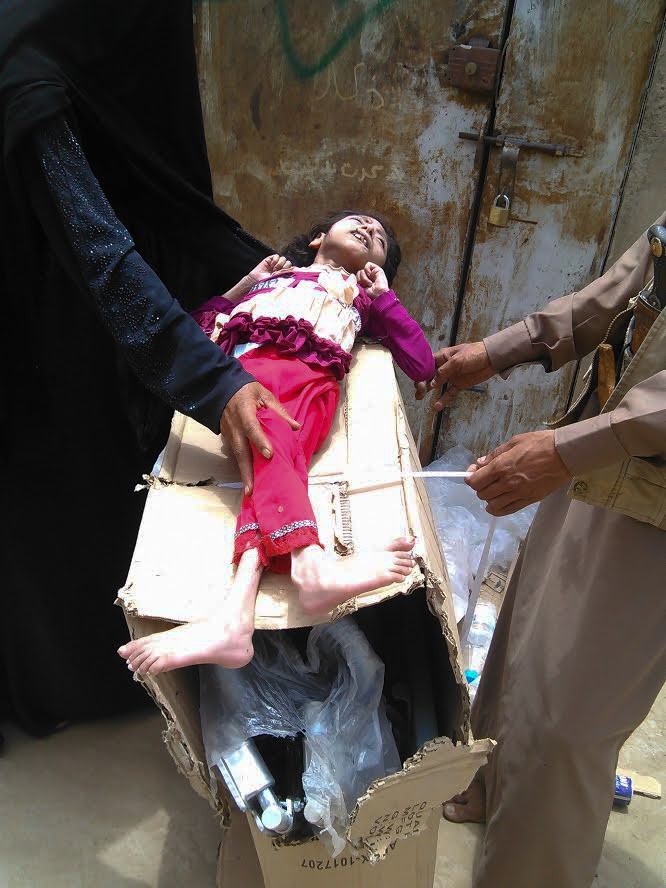 A young girl injured by a cluster bomb dropped by a Saudi warplane is fitted for a wheelchair near the Yemen-Saudi border, March 18, 2020. Photo | YEMAC