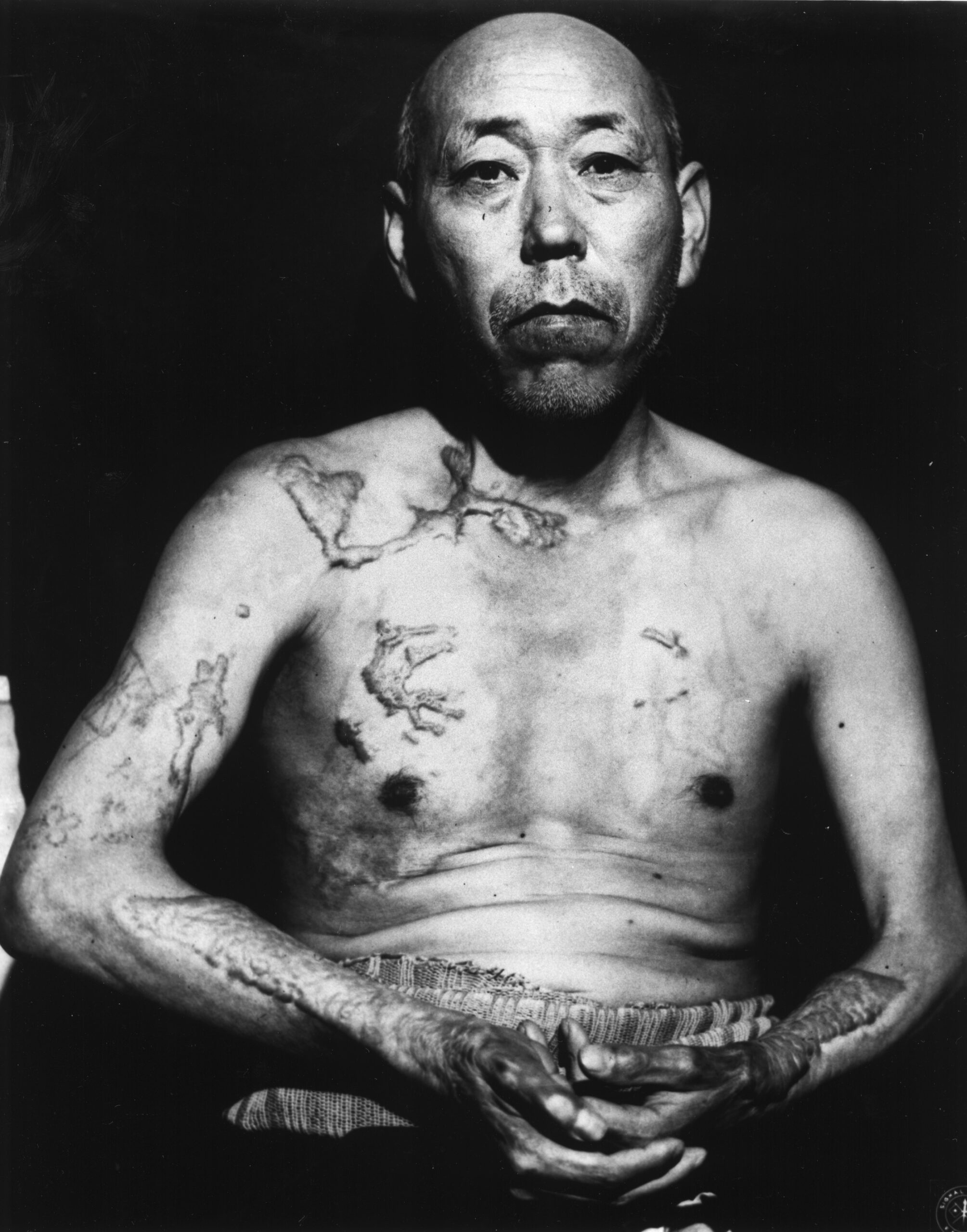 Hiroshima survivor